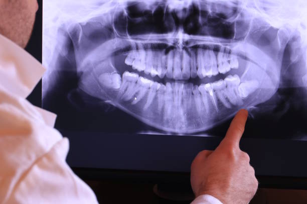 Best Root Canal Emergency Dentist  in College Station, TX